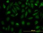 FH Antibody (monoclonal) (M07)